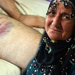 yil oldu kackadina miras yok deyip oglunu dovduler 28sdQObh