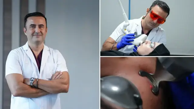 akne tedavisinde koruyucu hekimlik onem tasiyor yeni nesil yontemlerle etkili sonuclar VKLrAD6f