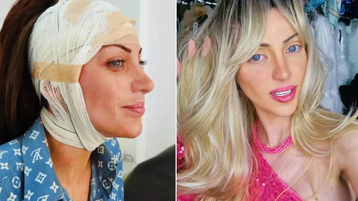 barbie bebege benzemek icin 27 kez ameliyat oldu brezilyali fenomen 31 yasinda hayatini kaybetti bxeNRqqa.jpg